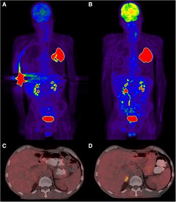 The decision to reimage following extravasation in diagnostic nuclear medicine